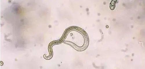 眼弓蛔虫病是由犬弓蛔虫或猫弓蛔虫的幼虫侵犯眼内组织引起的感染性