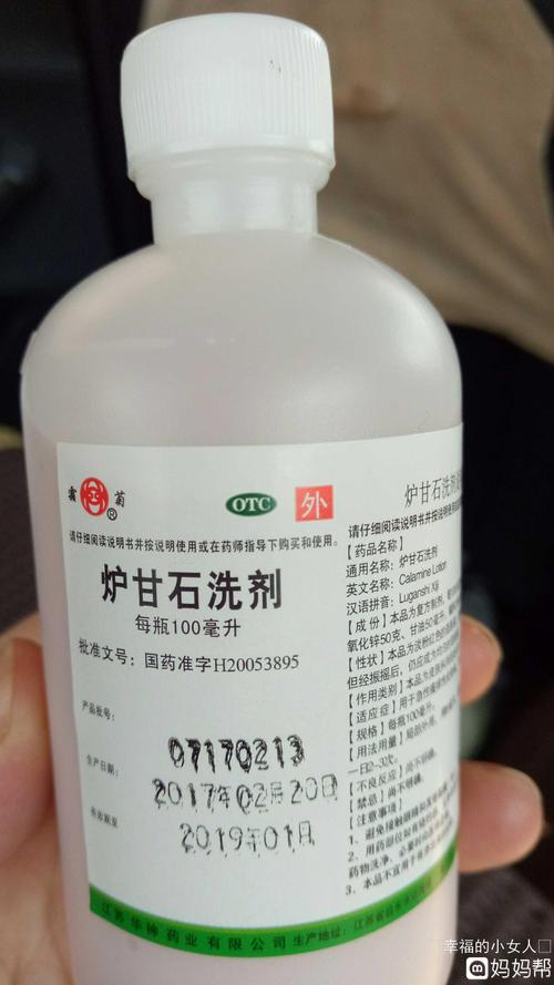 孕妇出痱子可以用炉甘石洗剂吗