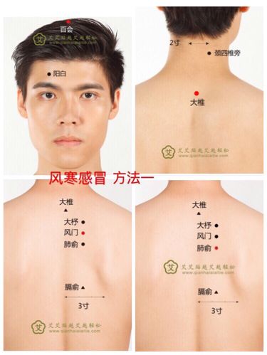 风寒感冒,风热感冒,暑湿感冒的症状及艾灸方法
