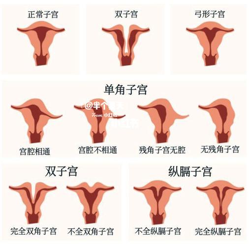 宫腔镜后～等姨妈(二)_后怎么样_子宫_浙江省中医院_宫腔镜_医疗健康