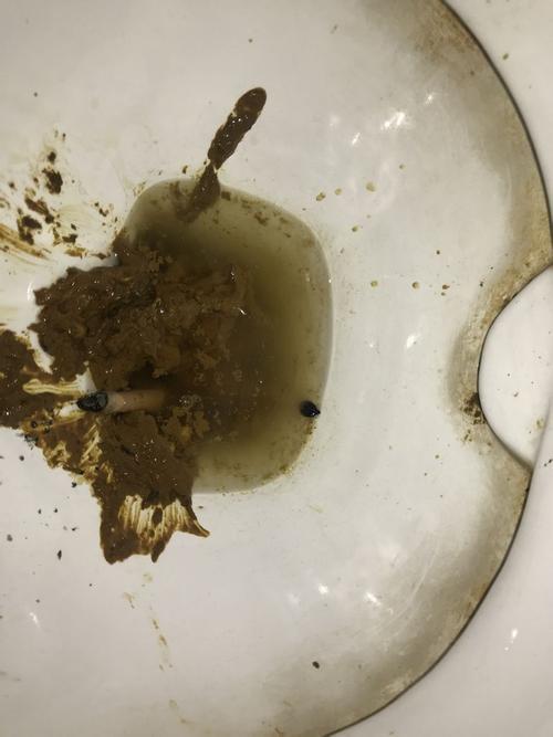 一直大便都稀不成型 颜色应该正常