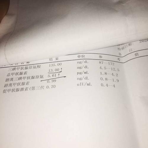 甲功五项会看单子的进