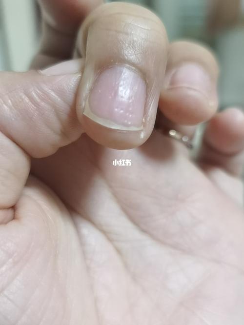 指甲坑坑洼洼_善存怎么样_美妆_美甲