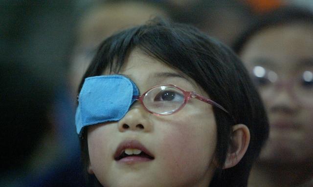 5,孩子散光什么情况下要治疗?