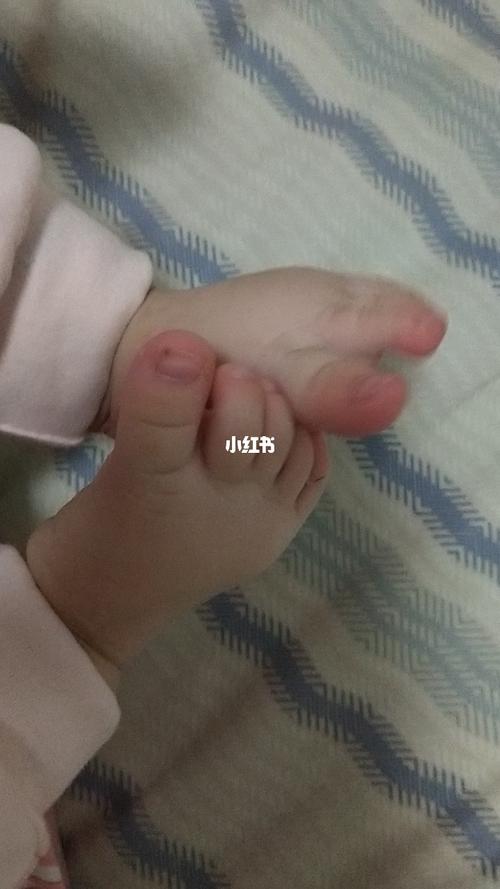 宝宝五个月了搓脚是怎么回事?求解_萌娃_萌娃_宝宝日常
