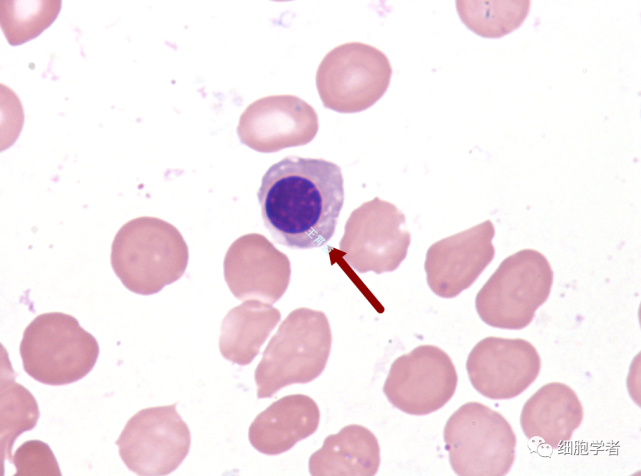 中幼红细胞 