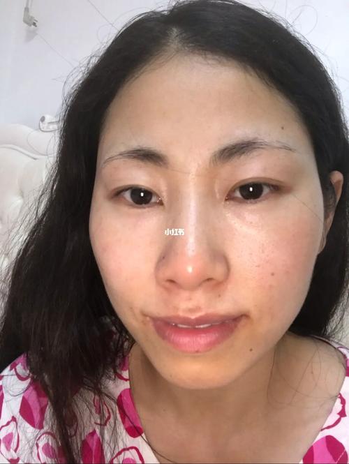 自拍好丑呀_肤色_美颜_黑头_毛孔粗大_皮肤管理_美妆_护肤_护肤其他