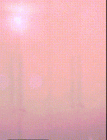 前一段去医院做了个痔疮小手术.