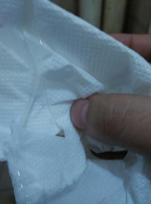 这样是白带拉丝吗