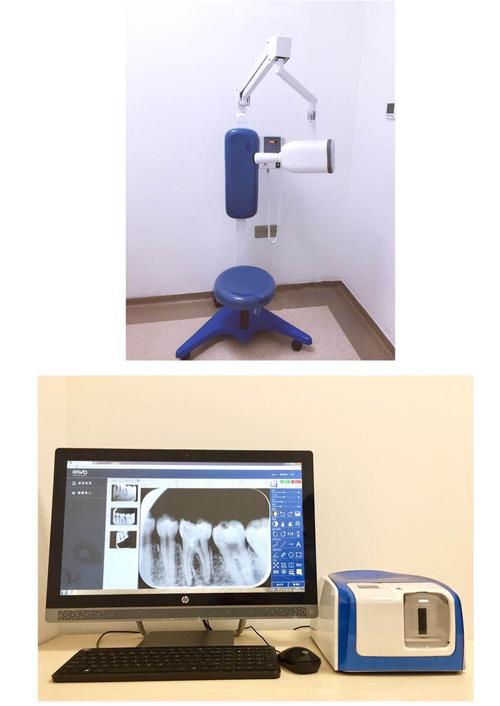 口腔数字化牙片机