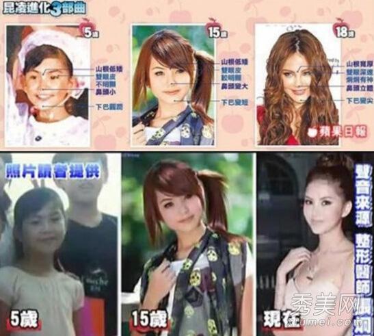 图揭昆凌整容细节 旧照曝光鼻塌脸肿