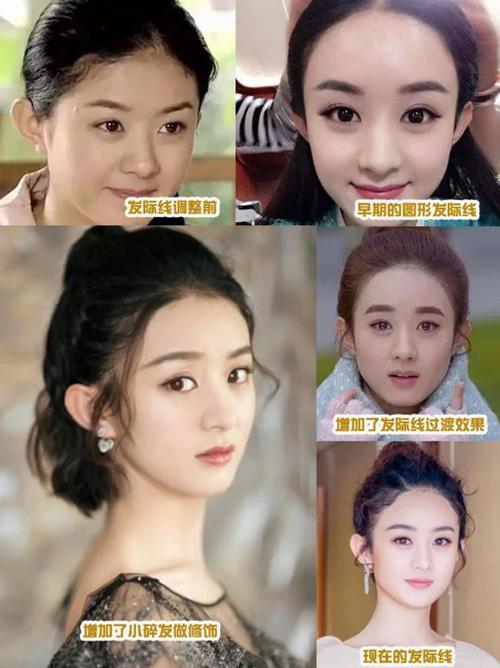 发际线高的女生,可别乱剪头发!换对这4种"刘海",减龄显脸小