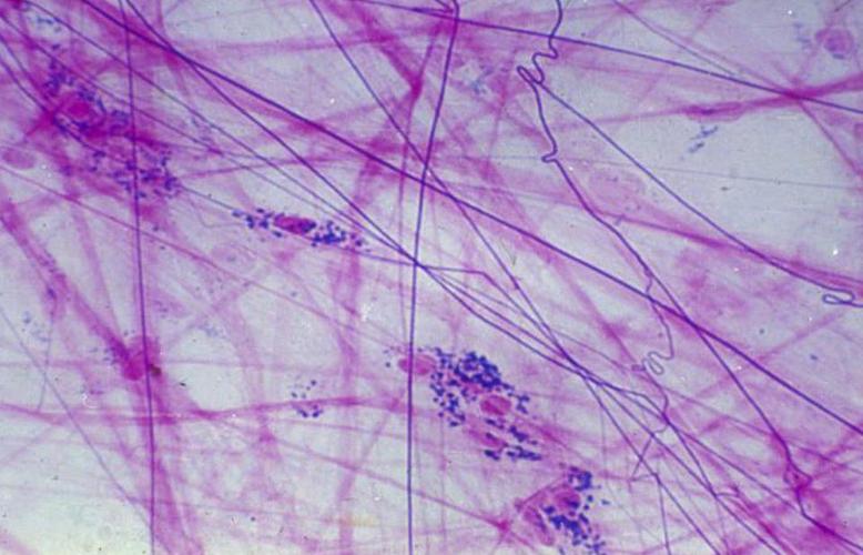  p>弹性纤维位于 a href="#" data-lemmaid="19185506">真皮网状层 /a