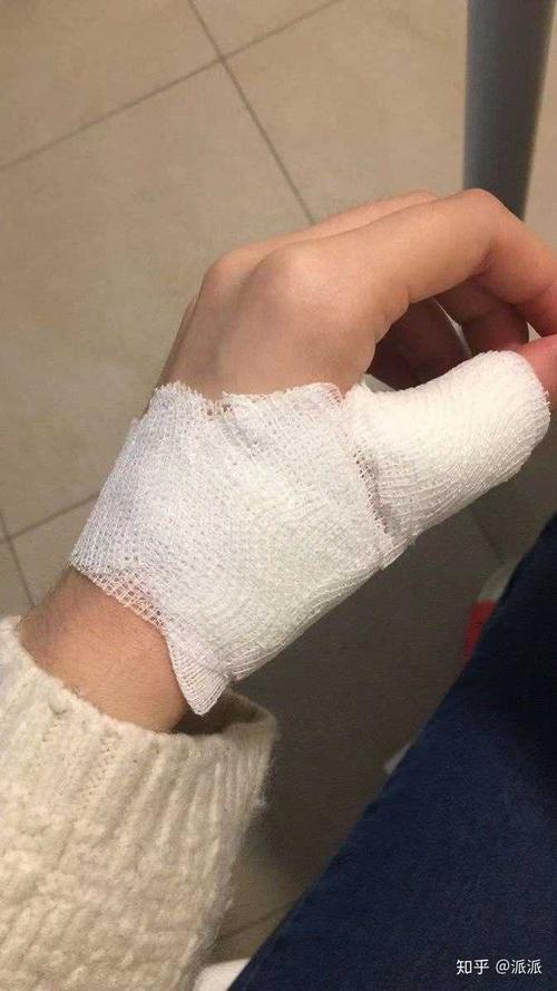 烫伤前后皮肤的具体变化是怎样的?