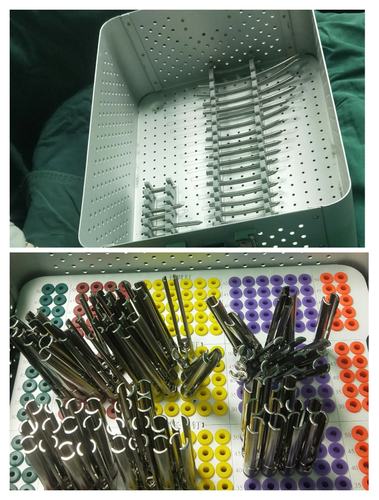 腰椎骨折椎弓钉微创器械