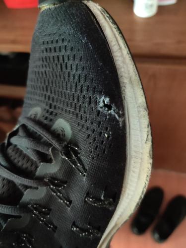 〔岁静〕鞋子被脚趾磨破了