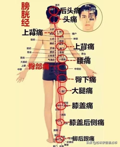 痛症总论——痛点不固定,全身痛,全身肌肉痛,三步走帮