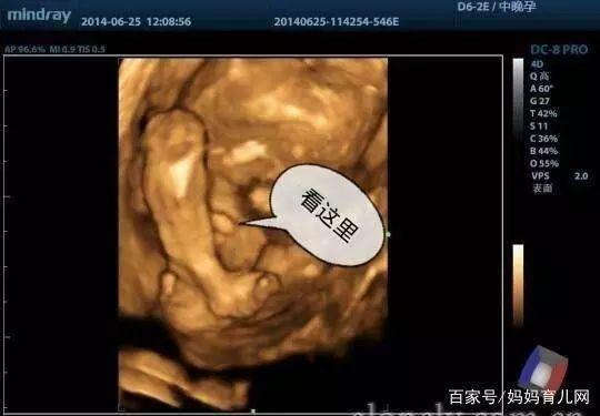 谈起四维彩超,孕妈们第一个想到的恐怕是胎儿在腹