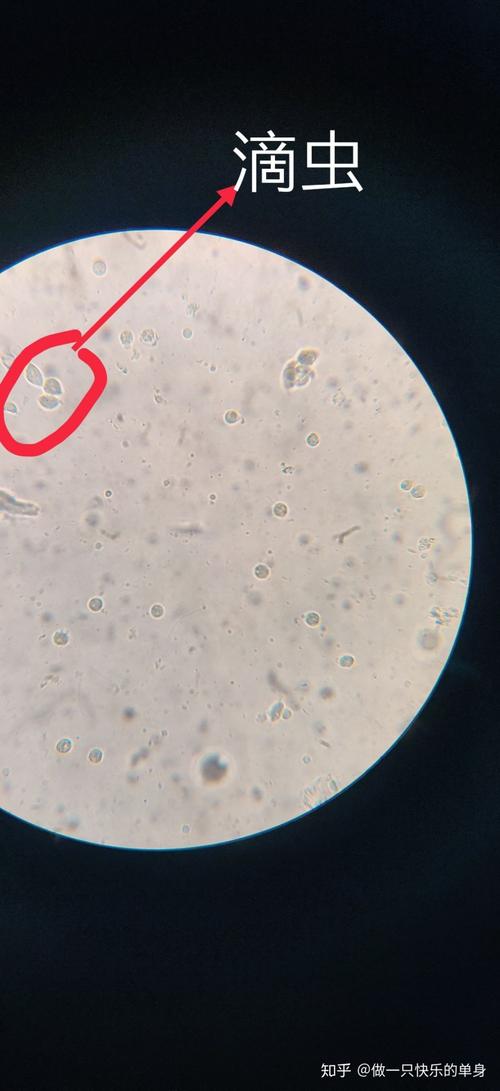 妇科白带常规显微镜下图片