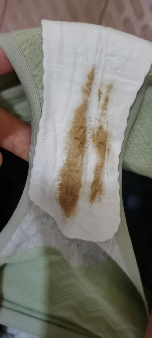 你们也是这样的吗排卵期出血附上图片