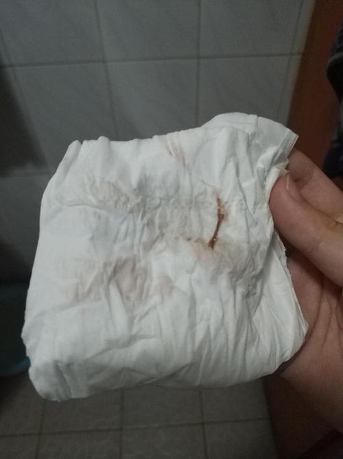 姐妹们这个是排卵期出血吗有图慎点