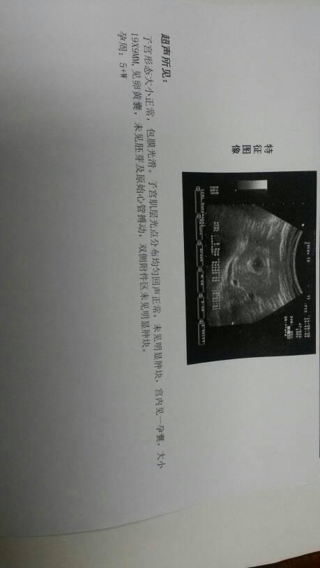 问:请问葡萄胎有什么征兆吗?