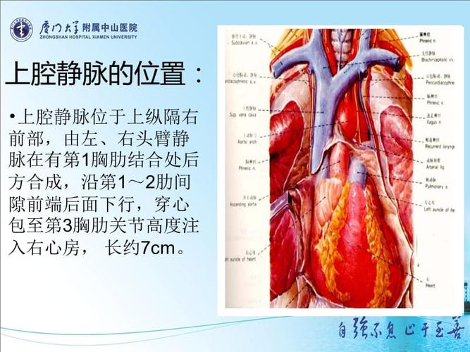 上腔静脉阻塞综合征.ppt