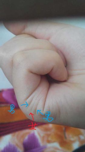 有一些横向的纹路,就是我们今天要说的"子女线" 子女线多条,有深有浅