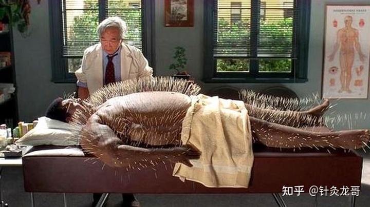 针灸治病必须扎病变部位吗病位不明确或不固定的疾病该怎么治