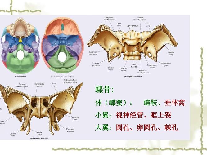 蝶骨: 体(蝶窦): 蝶鞍,垂体窝 小翼:视神经管,眶上裂 大翼:圆孔,卵