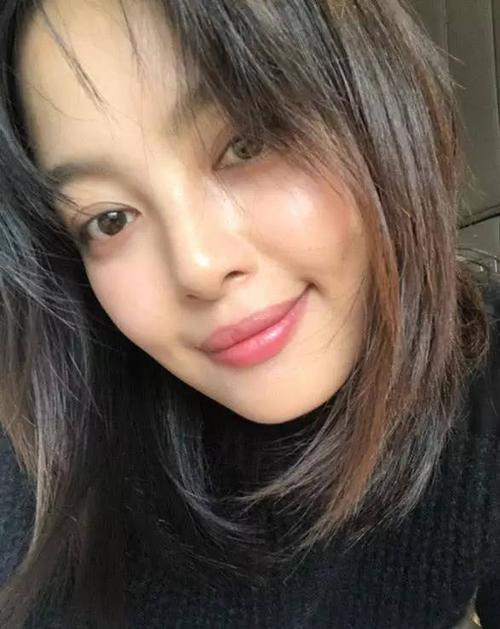 辛芷蕾微整手段高明?"金鱼眼""香肠嘴"被喷照样火?
