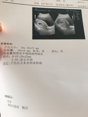 孕8周2天去b超孕囊周围有出血,开了保胎药,让卧床休息