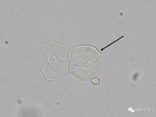 ▼ 2017513:移行上皮细胞(表层)