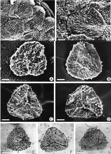 倒卵形格子蕨(clathropteris obovata)孢子囊和原位孢子特征