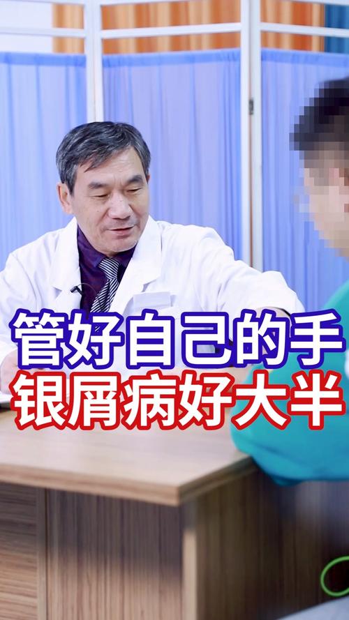 银屑病#管好自己的手,银屑病好大半
