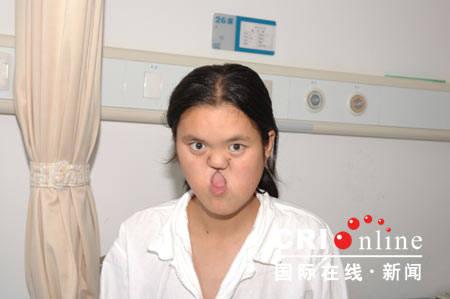 世界首例"坑面"少女修复手术(组图)