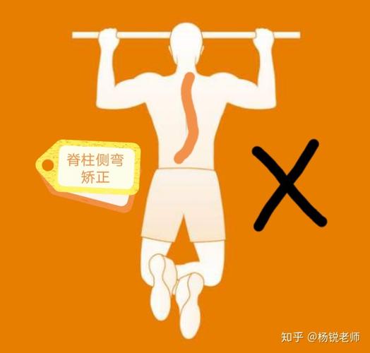 辟谣吊单杠能治疗脊柱侧弯吗