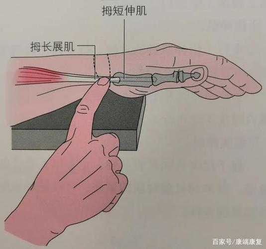 关节功能解剖图解:推拿,按摩,扳机点与运动治疗 疑有桡骨茎突狭窄腱鞘