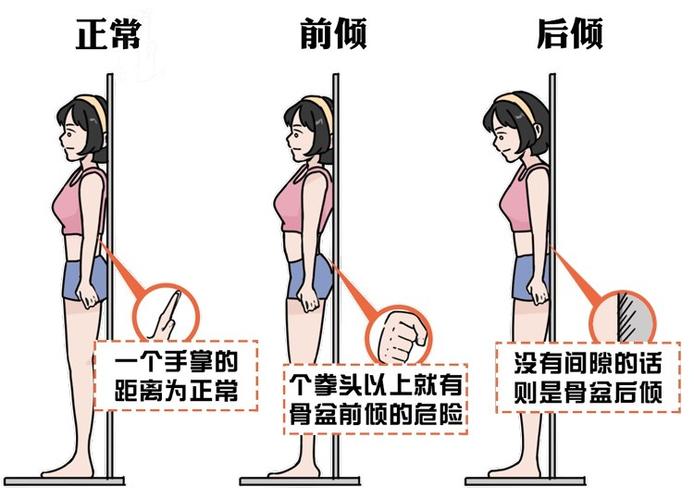 原创骨盆前倾危害大,如何自我测试和纠正?看这一篇就够了,男女通用