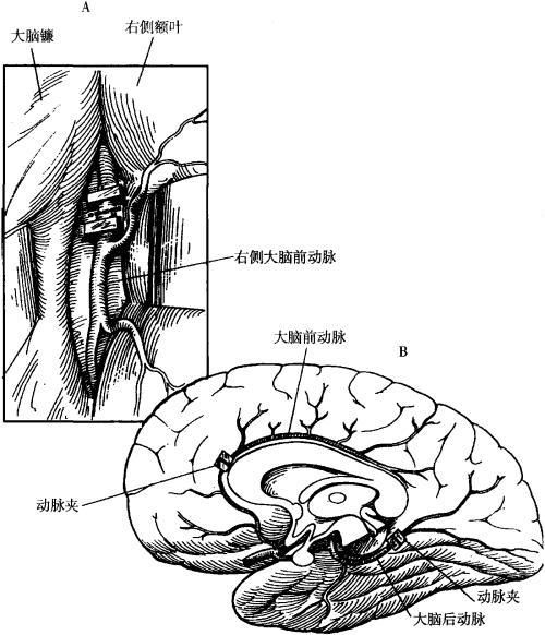 人脑结构图简笔画