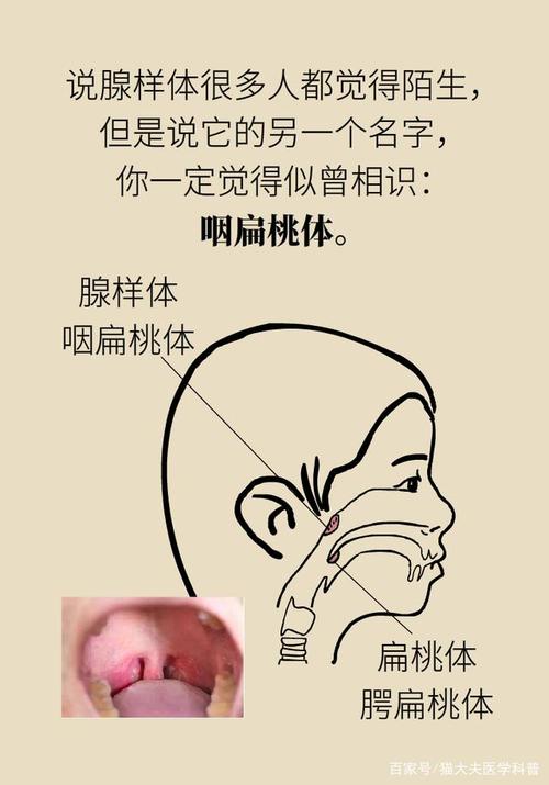 小孩腺样体肥大,一定要手术切除吗?