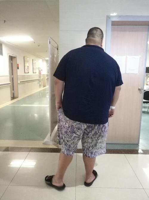 一年胖了180斤是怎样的体验?比肥胖更难过的是白眼