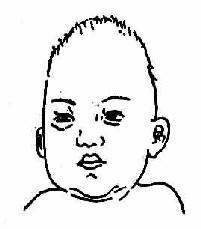 第一节 头颅skull