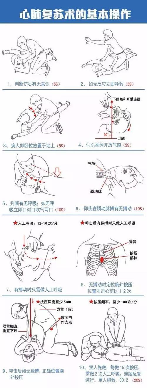 胸外心脏按压的方法