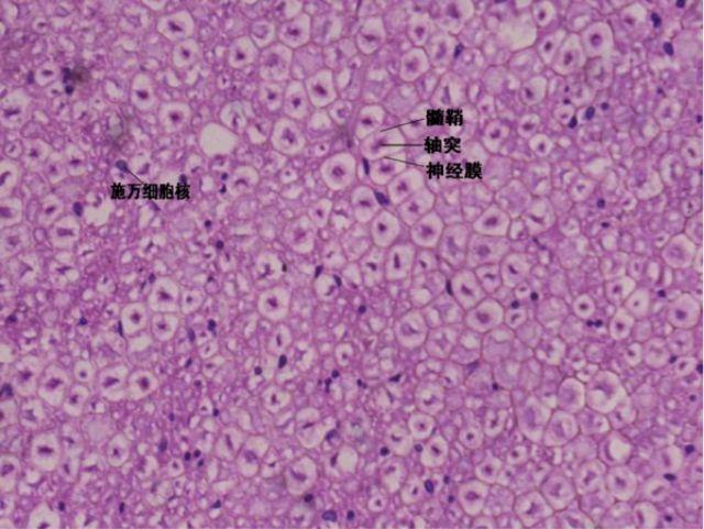 脊髓的组织切片