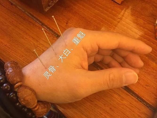 灵骨,大白,重魁,三针同下为倒马针法,可通三焦,调理全身.