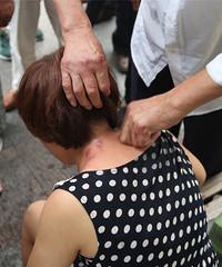 昨天下午4时许,在湖滨公园,一位女性游客中暑了,两位大伯大妈见状,在