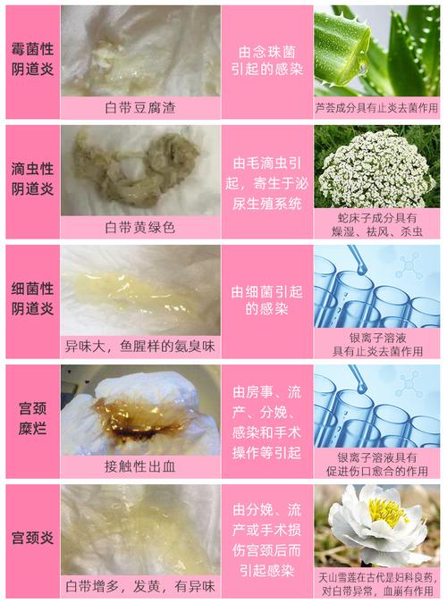 仁和妇科苦参凝胶私处护理宫颈烂糜妇用药私密抑菌止痒子宫去异味