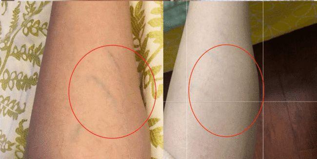 腿粗的女生求求你别乱穿了这样穿120变90斤睡觉都在瘦