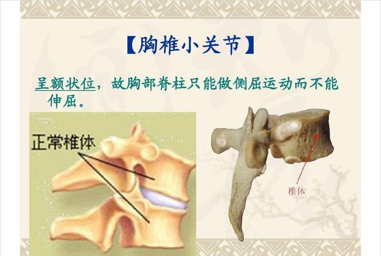 脊椎小关节紊乱